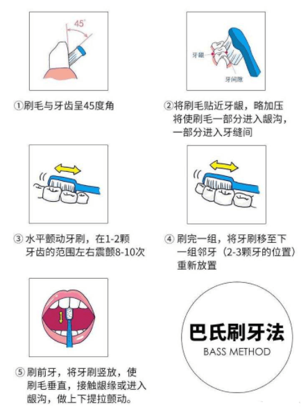 电动牙刷对牙齿好吗?谨防三大伤牙弊端!_口腔_牙龈_好处