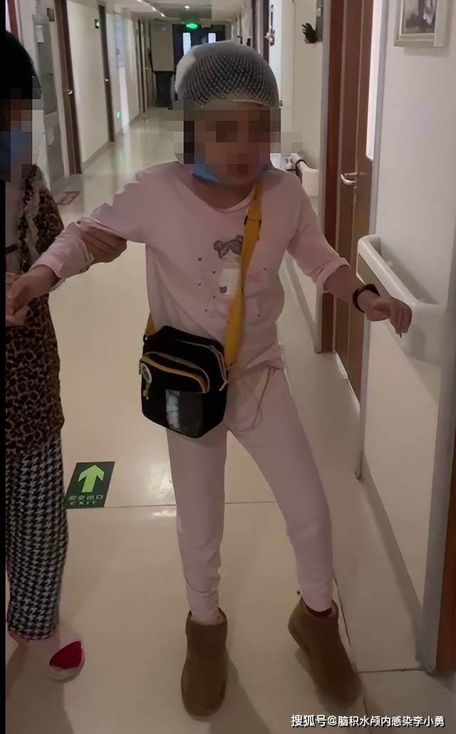 脑积水分流术后并发症脑坍陷意识丧失全身木僵肢体震颤双脚呈芭蕾舞脚