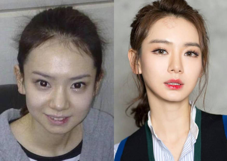 可能有很多人都不知道,其实戚薇之前是单眼皮,不过出道以后,戚薇就去