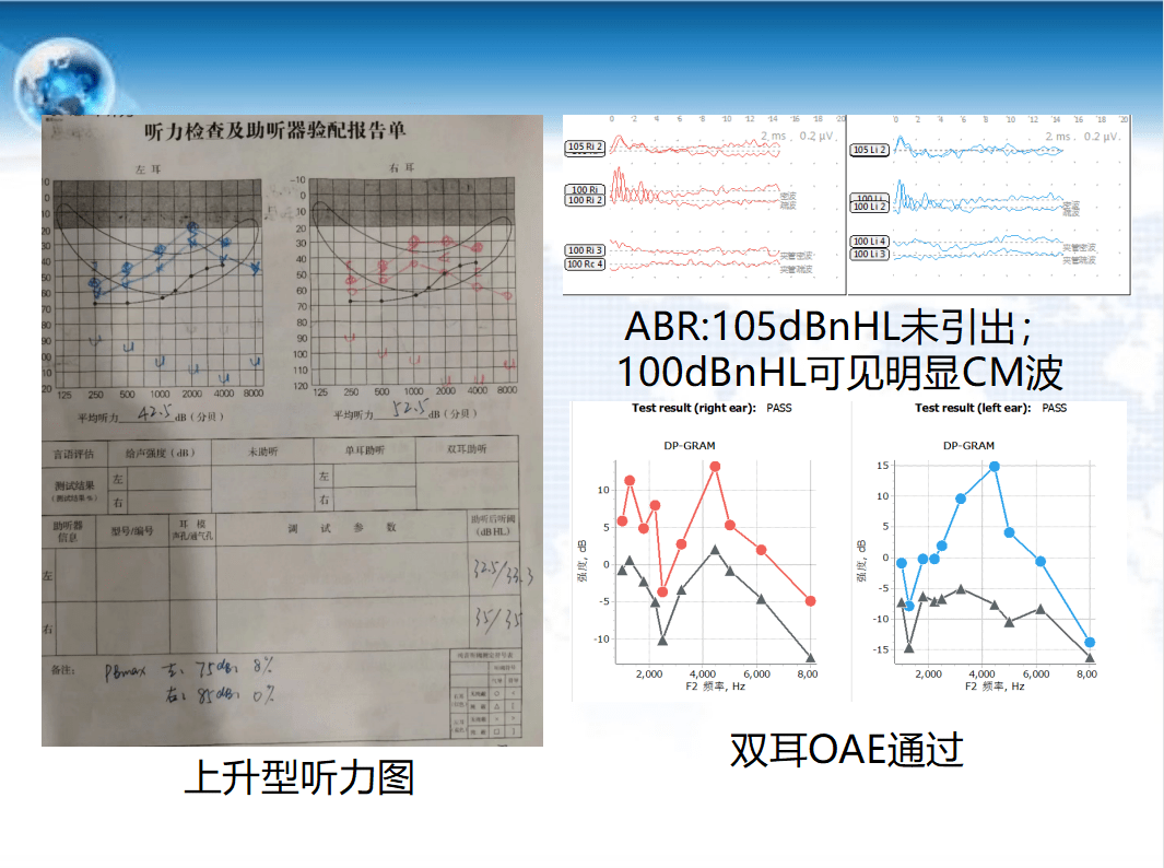 听力检查报告正常图片图片