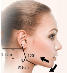 我们亚洲人很多人下颌角位置天生后突,有些人的下颌骨在耳垂下方,这样
