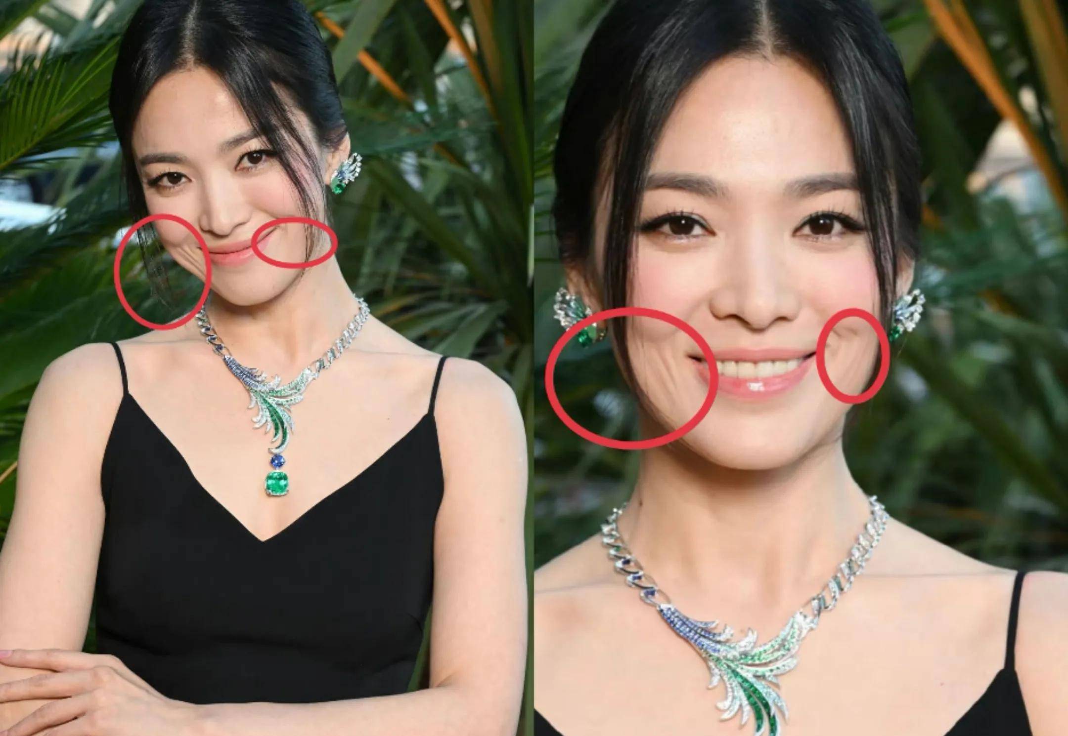 汤唯的眼纹,章泽天的长下巴,宋慧乔的法令纹,容貌焦虑该停止了_皮肤