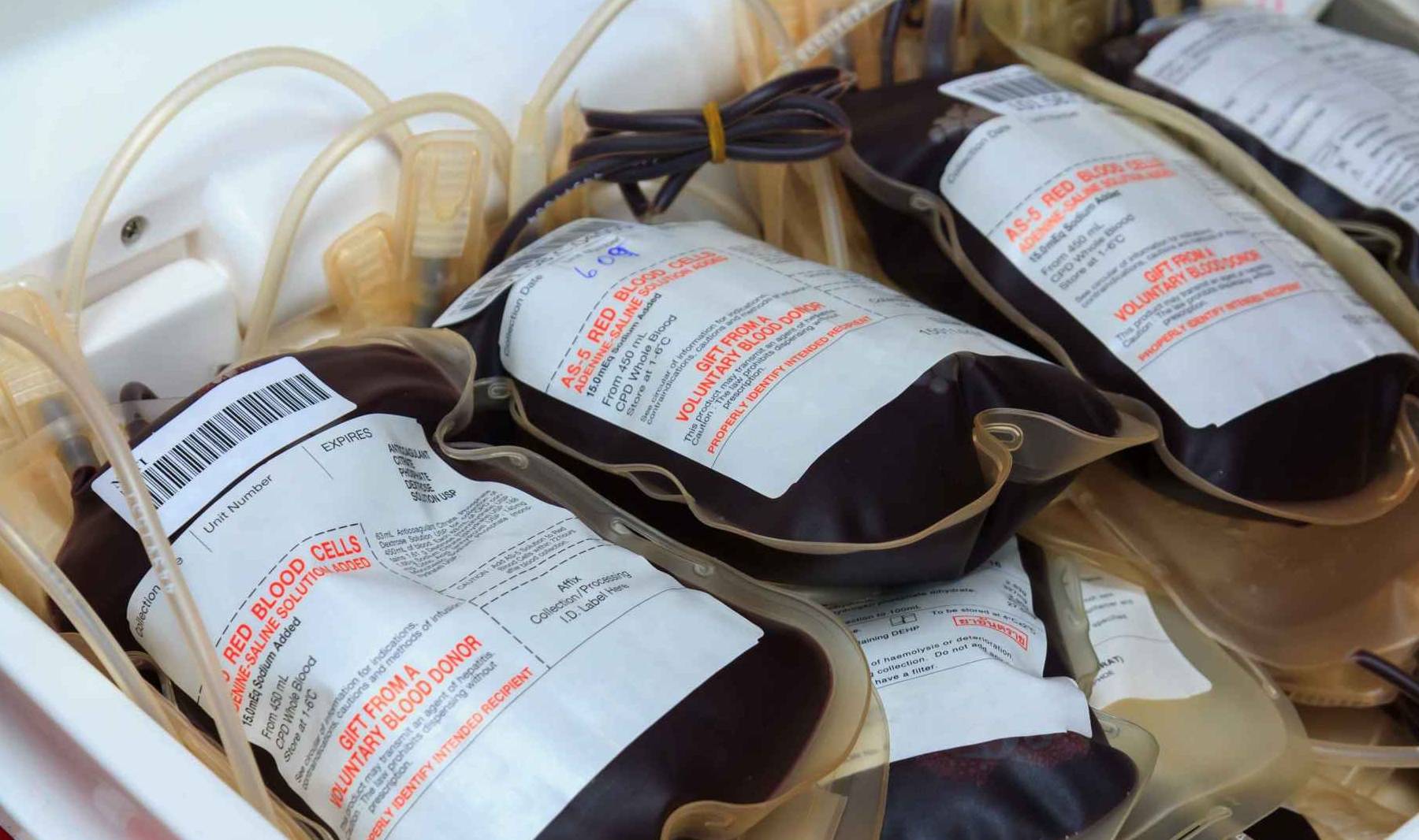 每年献血400毫升,可能会轻松得到几个好处,很多人还不清楚_血液_身体