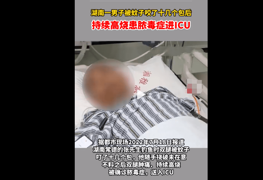 孩子被蚊子叮咬如何快速止痒消肿？