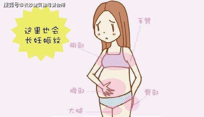 什么是妊娠纹？妊娠纹能彻底消除吗?？