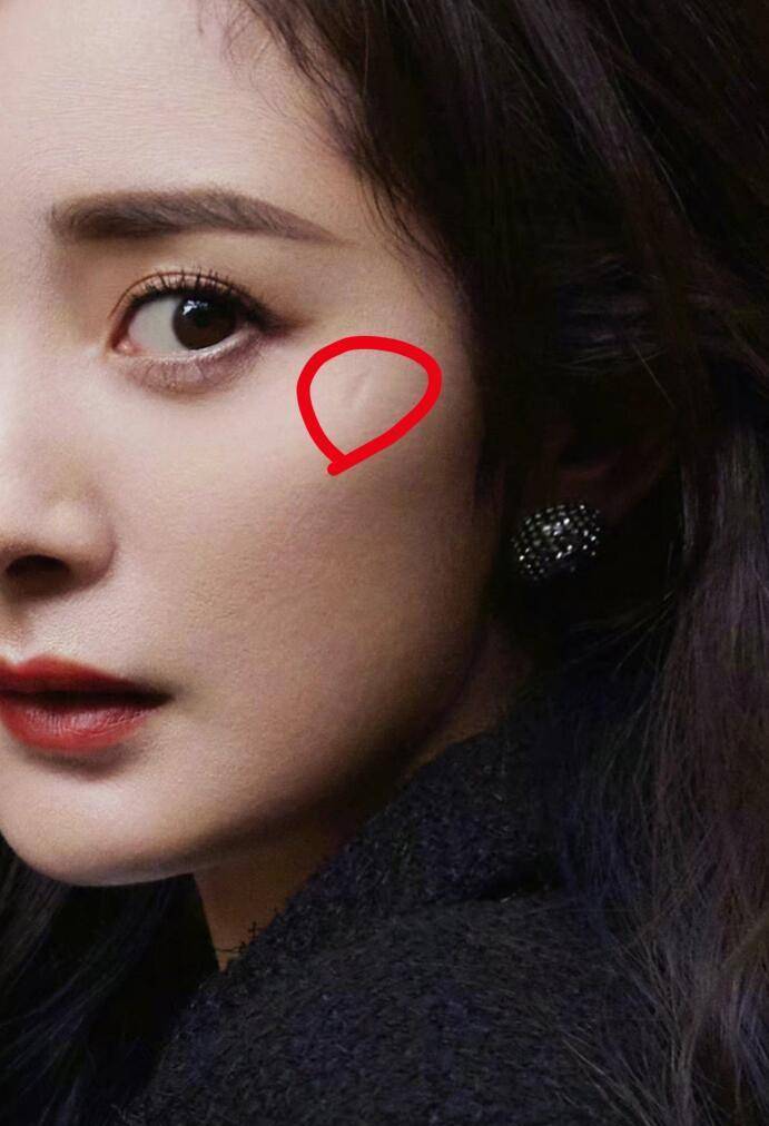 杨幂《密逃》受伤后,节目还在继续录制,粉丝团透露为她治疗的是专家