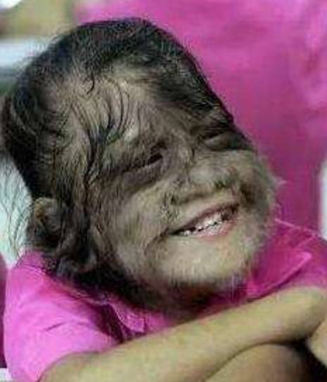 世界"体毛"最长的女人,比"孙悟空"还珍贵,剃毛后美艳绝伦_艾米丽