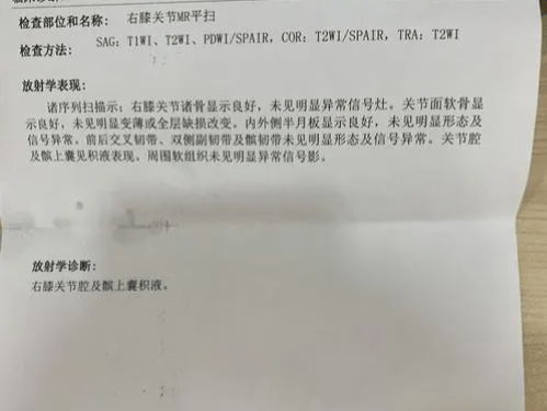 颠覆!每天几毛钱就能搞定滑膜炎?!过来人分享自治经历!!!_膝盖_情况_