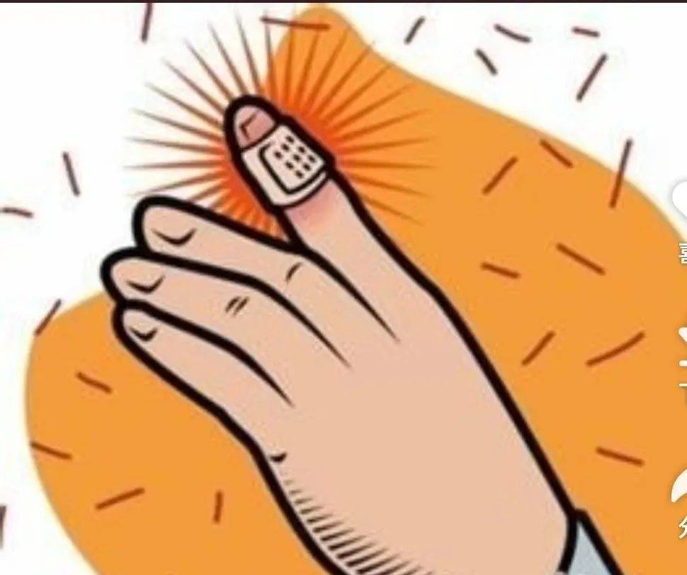 指甲被挤掉时,最重要的是防止细菌感染.4.