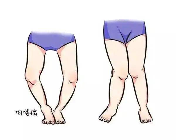 震惊宝宝缺乏维生素d症状很明显却有50宝妈们不知道