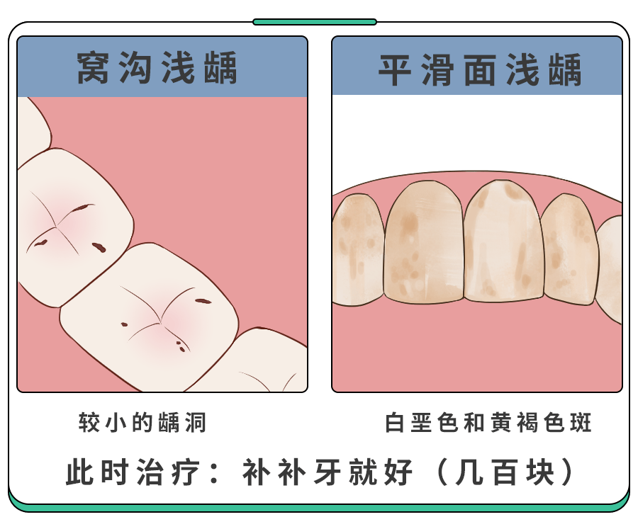 孩子龋齿严重花了15万手术！如何保护孩子的乳牙？