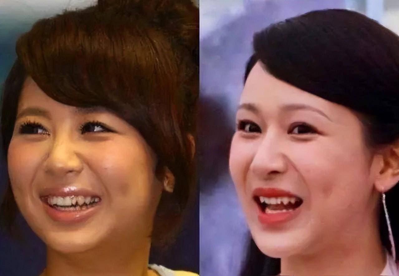 杨颖钟楚曦脸蛋自然,杨紫金晨却有后遗症_鞠婧祎_五官_杨颖钟