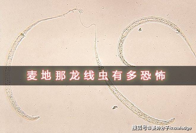 长达1米,钻破人体,2周才能拔出来,麦地那龙线虫有多恐怖?