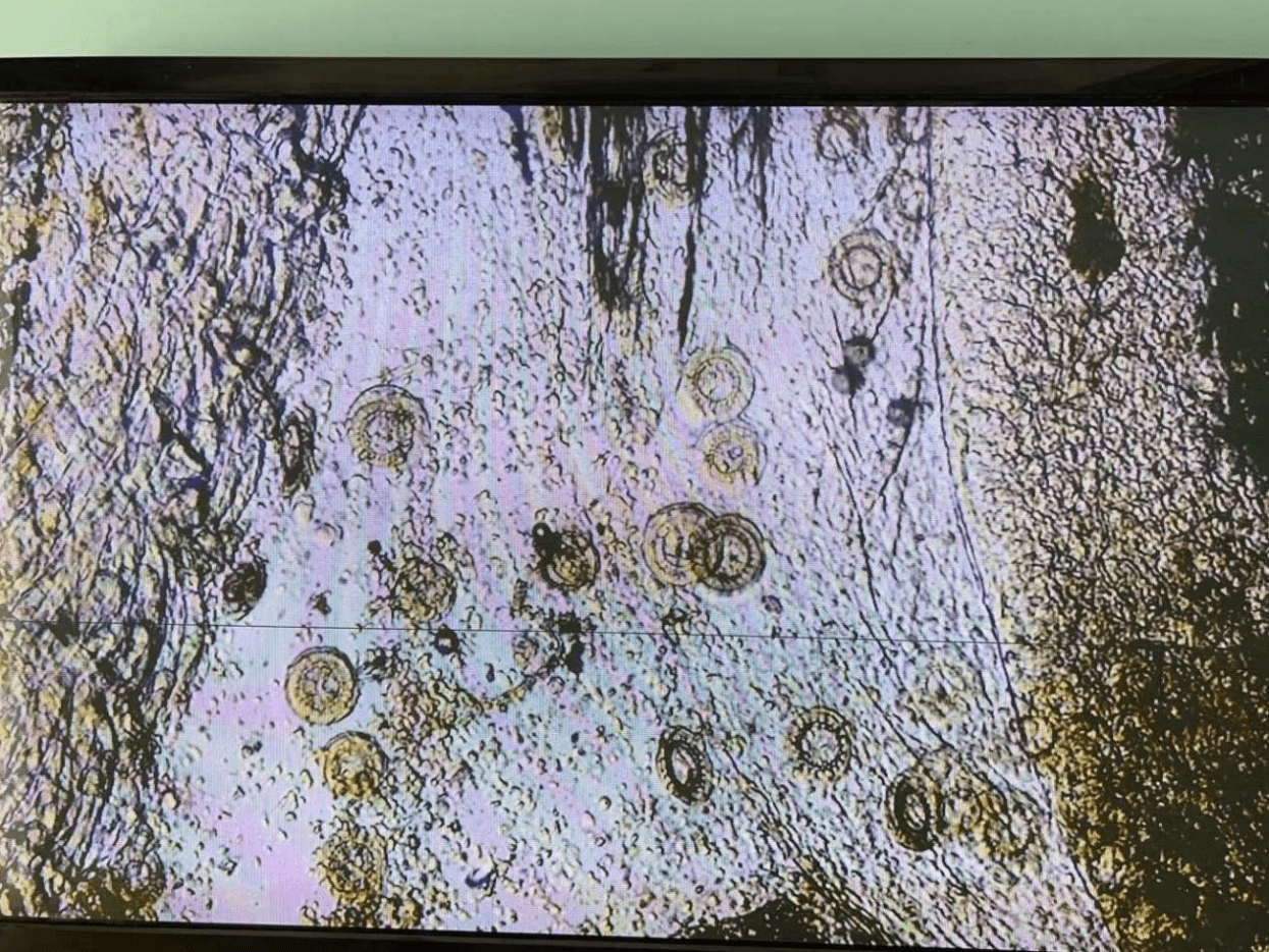 车轮虫席卷整个淡水鱼圈,为什么有的人却不担心?