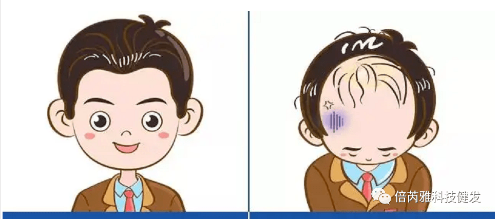 如何辨别毛囊的健康状态