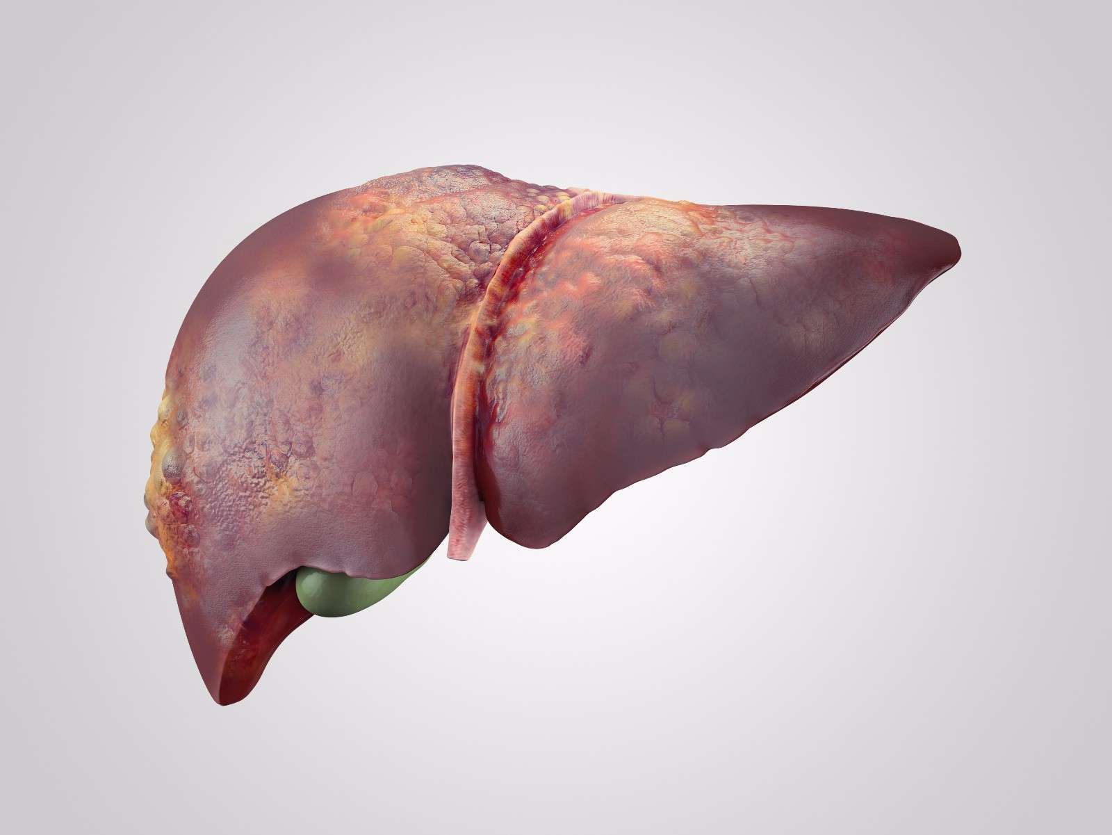 什么食物可以对肝脏肾脏有保护作用(附5种食物)