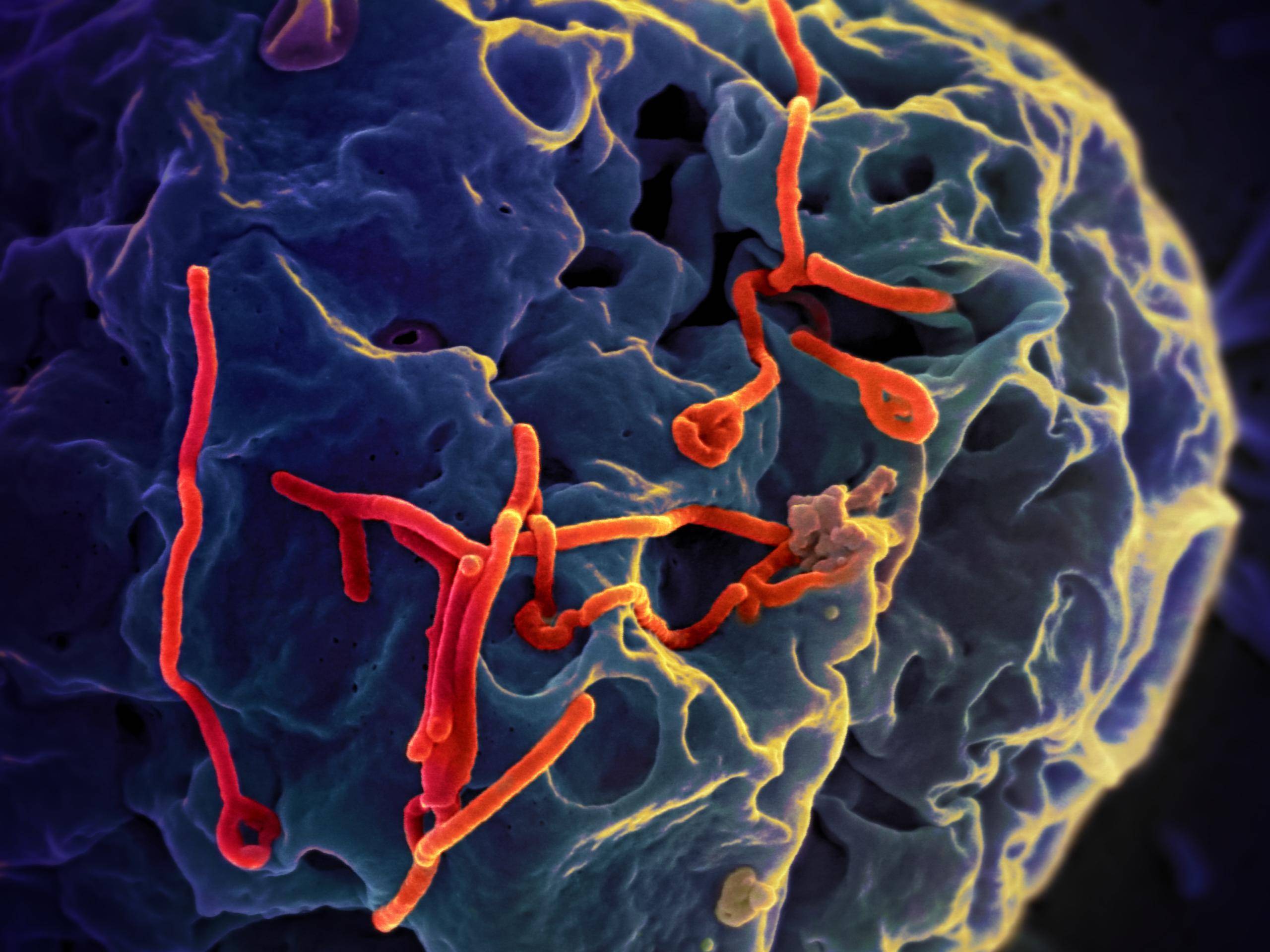 扎伊尔埃博拉病毒图片