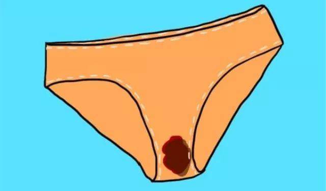 女人内裤黏黏的分泌物图片
