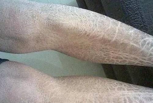 这4个原因需了解在农村老家,人们经常会管这种现象,叫做蛇皮人.