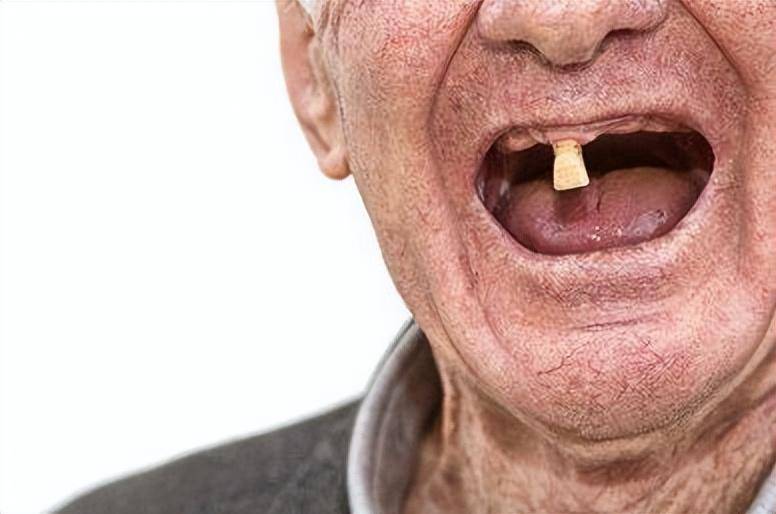 掉牙和寿命有关?60岁的人,牙齿剩多少颗才正常?