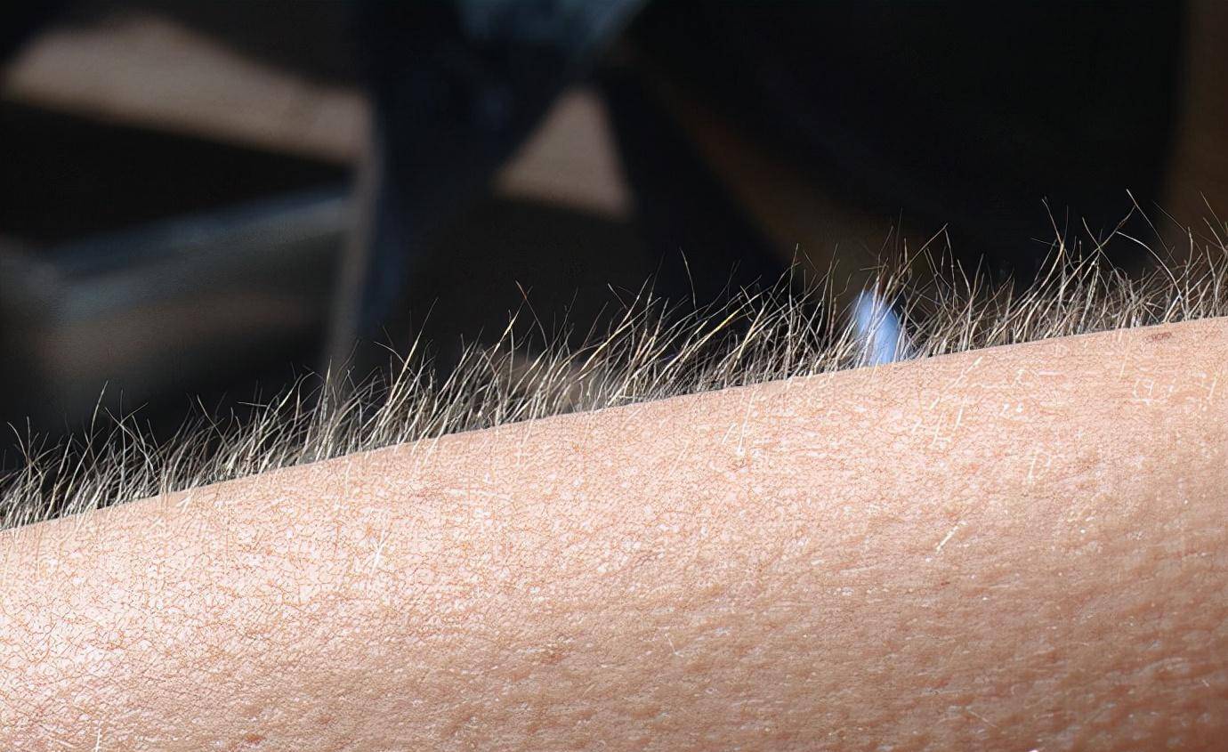 首先我们来说一下毛发,这是每个人身上必不可少的生理物质.