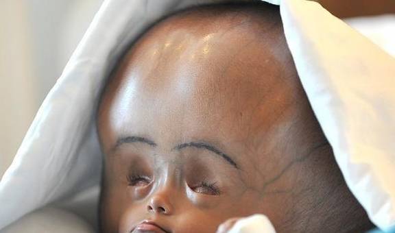 大头儿子是聪明脑袋还是有潜在疾病?_孩子_智商_宝宝