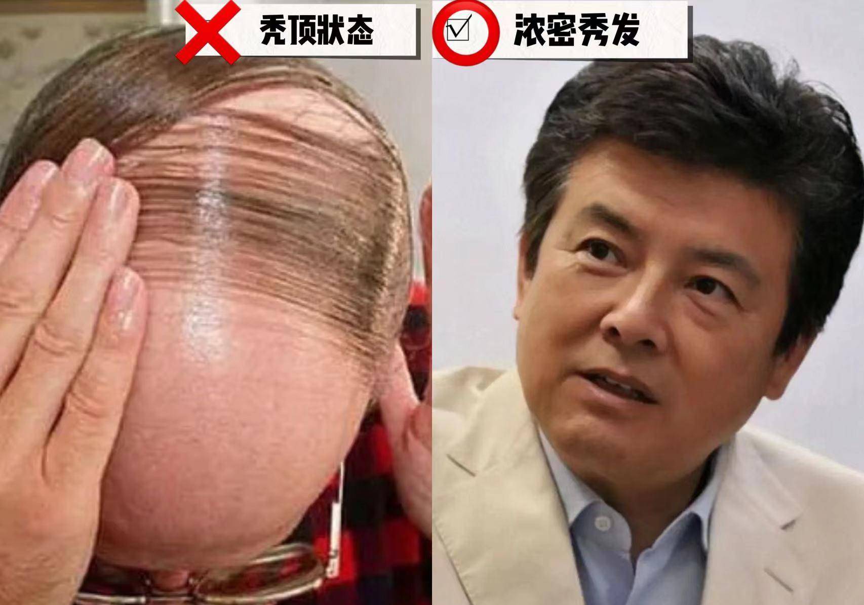 当然,反油腻的中年男子,发型保持整洁利落也是你拒绝油腻感的代表