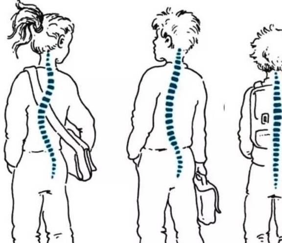 孩子總是彎腰駝背,該怎麼辦_姿勢_情形_問題