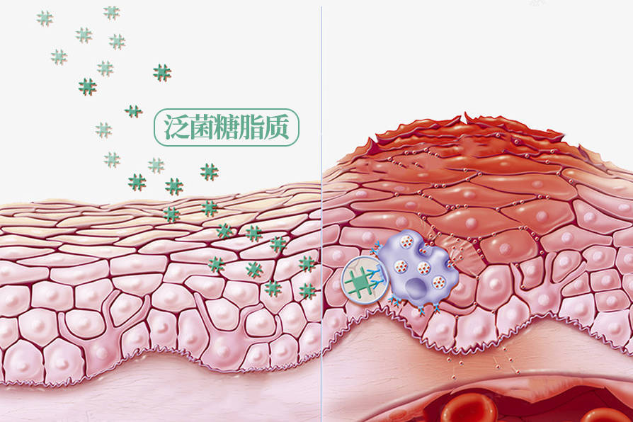 那些号称抗炎的食物真的有用吗？