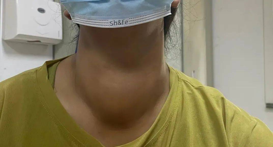 甲状腺囊肿在什么情况下需要做进一步处理?_癌变_风险_检查