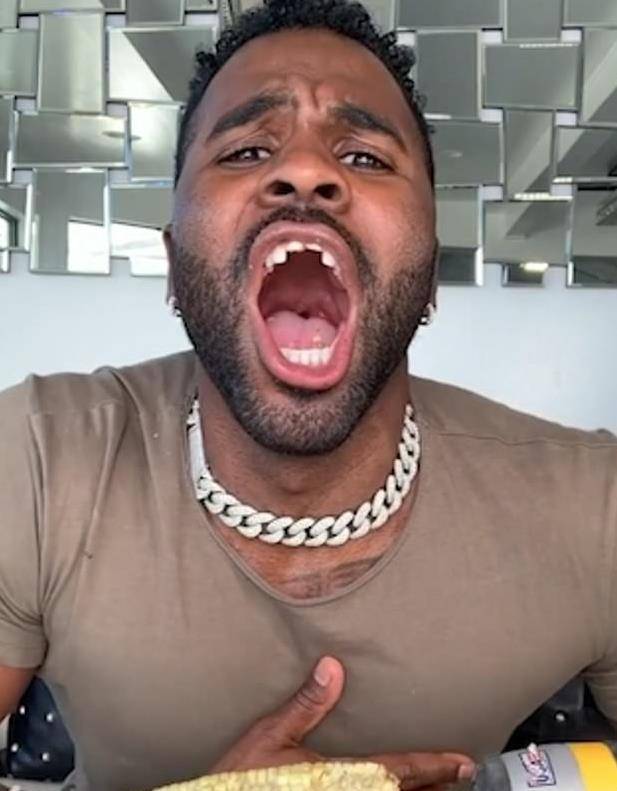 威尔史密斯与网红直播时被"误伤",高尔夫球杆敲断了两颗门牙_杰森