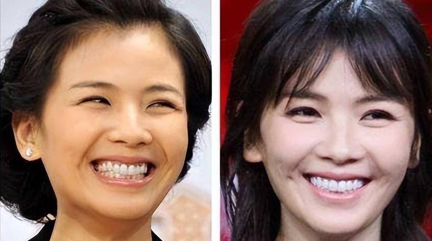 假头发,假屁股,"弄虚作假"的娱乐圈还有什么是真的_鞠婧祎_牙齿_刘涛