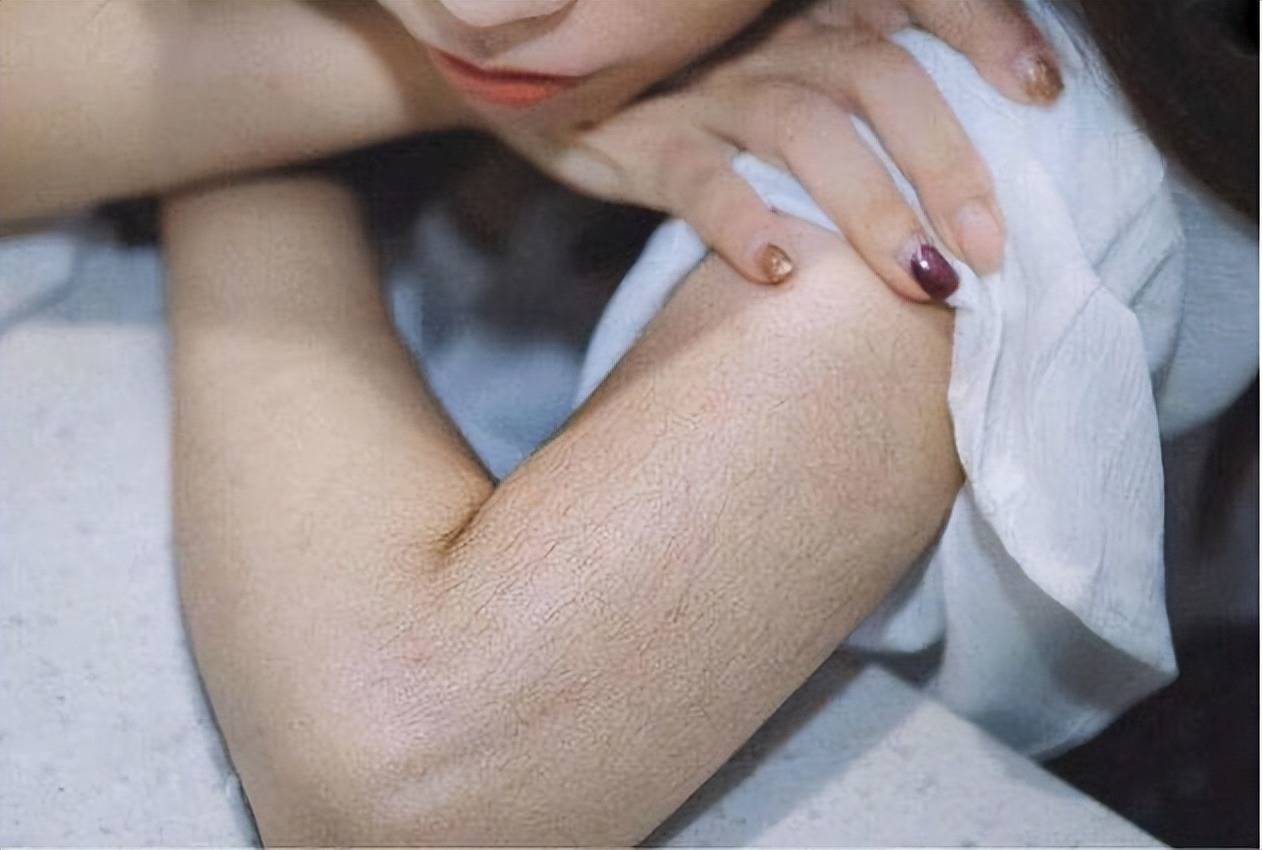 看完涨知识了_脱毛_毛发_保护