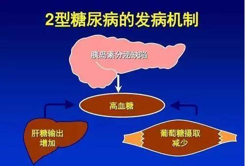 我國自主研發的新型降糖藥面市_葡萄糖_多格列艾汀_激酶