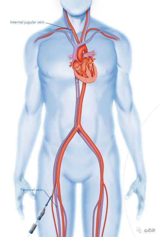 femoral artery图片