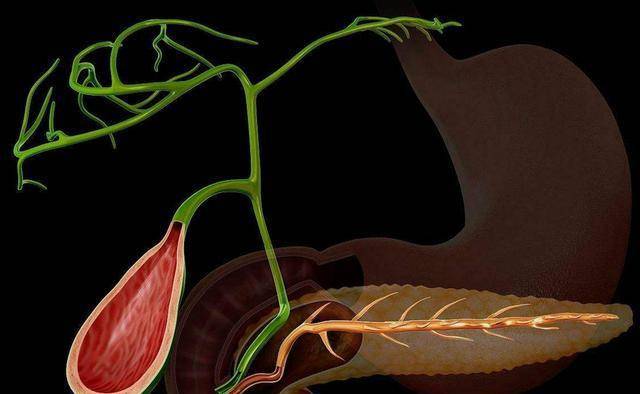 胆囊息肉一定会癌变吗?什么程度需要切除?