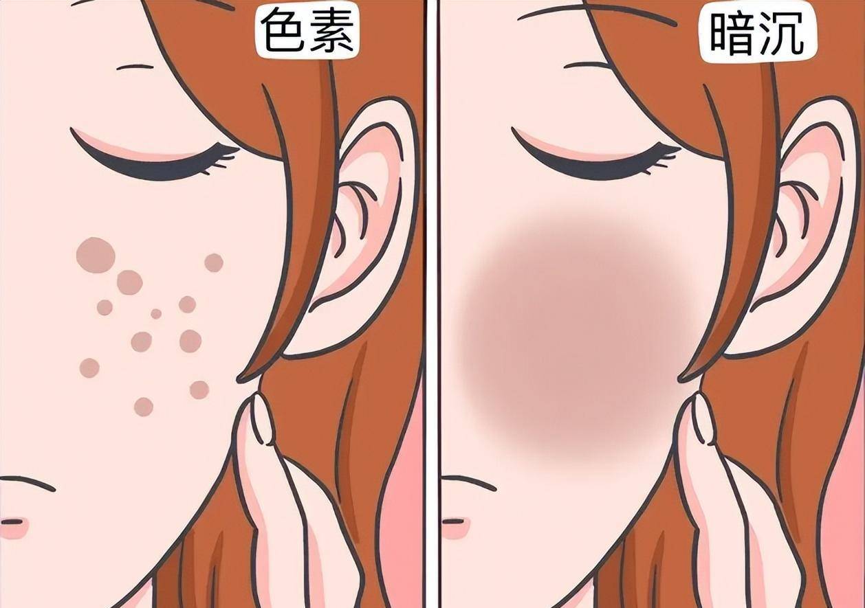 为什么疤痕有黑色素沉着?应该怎么去除?_治疗_皮肤_护理