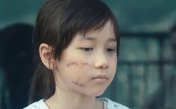 影片结束,伤疤却还在小女孩素媛出院了,为了能够让女孩心里的创伤愈合