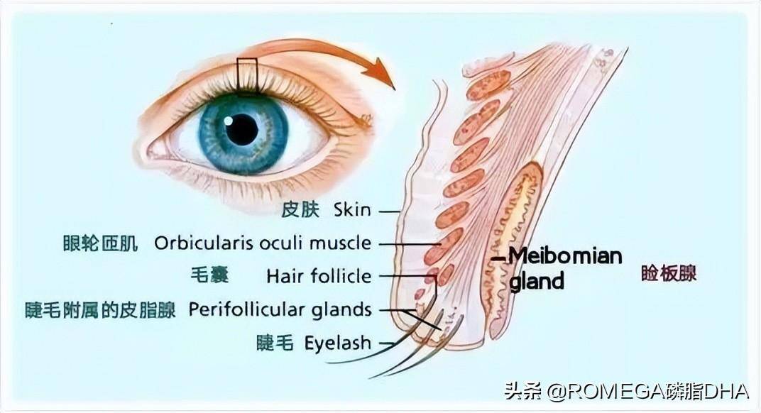 小心睑板腺功能障碍