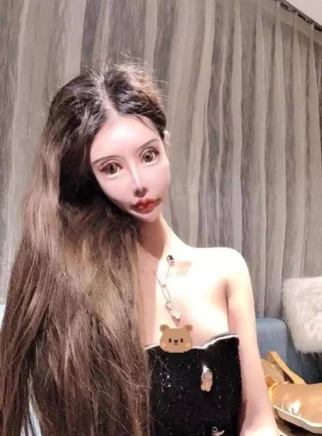 15岁女网红花400万整容,整容后的脸被许多网友吐槽_周楚娜_眼睛_手术