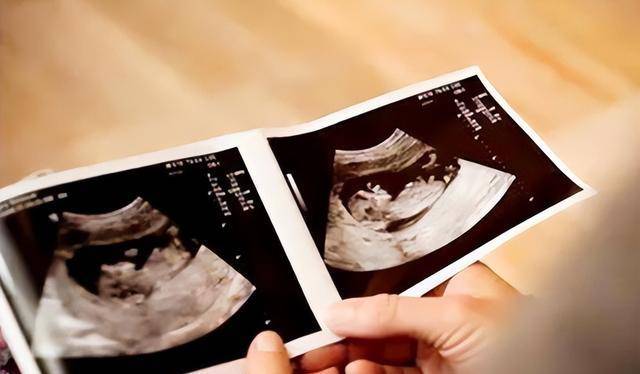 医生拿着b超单高兴的对高德金说道:"恭喜你,你妻子怀孕了,已经快4个月