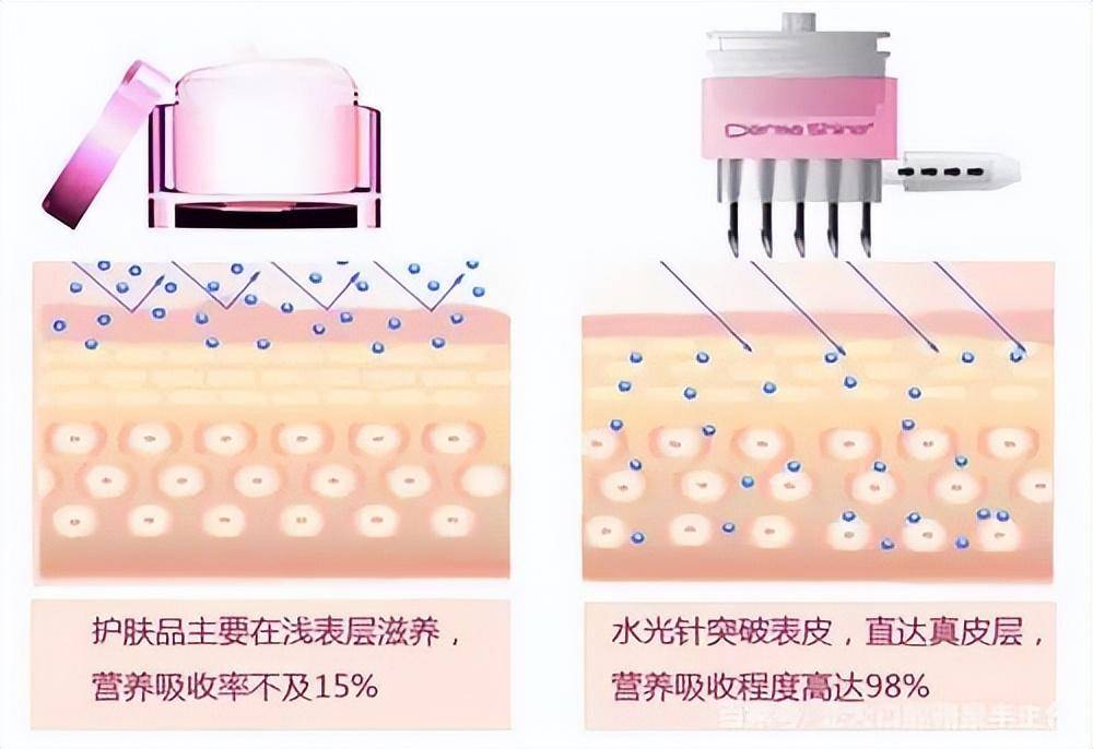 这都可以？（打了血检针 假怀孕吗）打了针还能验血常规吗 第2张