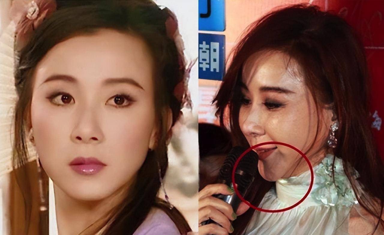 艺人爱上整容:削骨动脸很常见,甚至有人嫁给整容医生一辈子保修_萧蔷