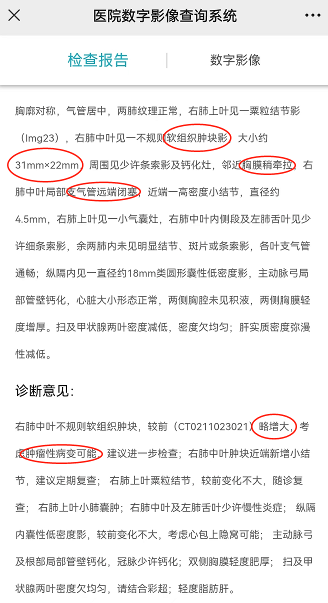 疑似肺部肿瘤ct报告单图片