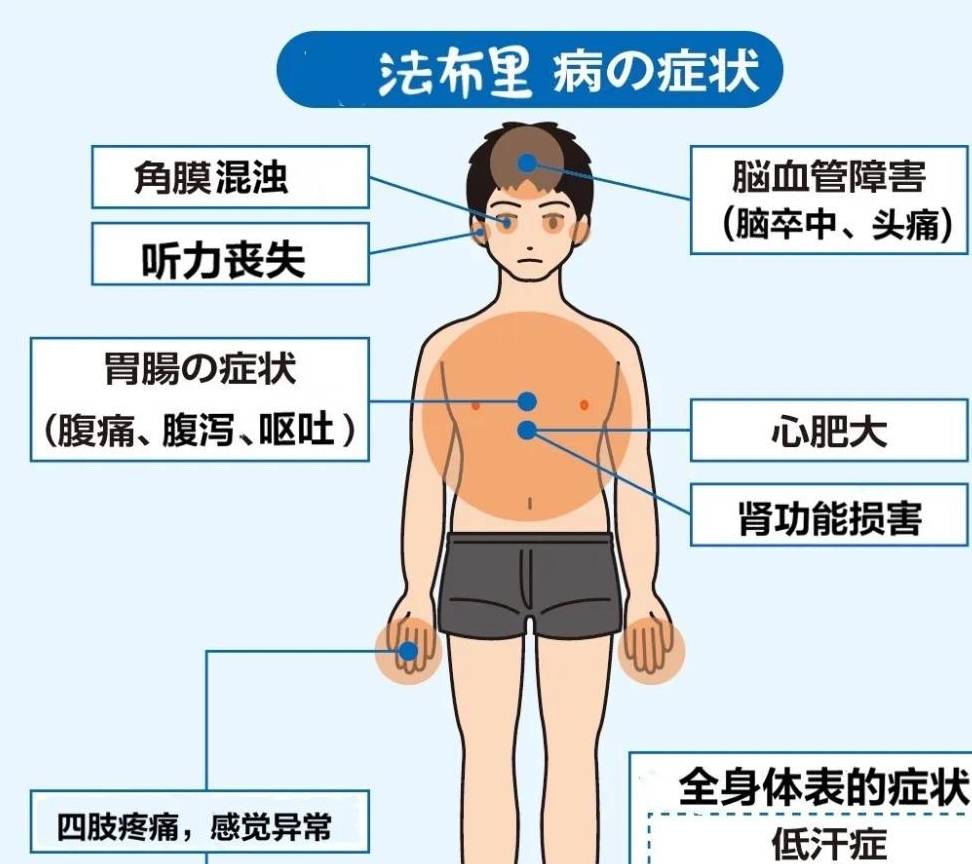 男童不明原因四肢末端剧烈灼痛,三年后确诊罕见病法布里病_治疗_患者