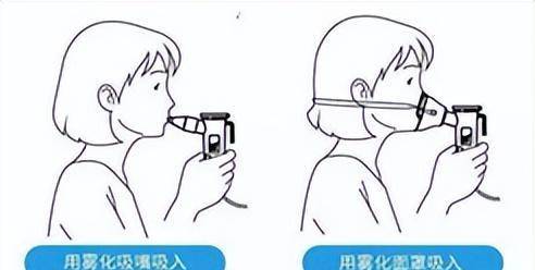 干粉吸入剂?不如试试雾化吸入!_药物_操作_装置