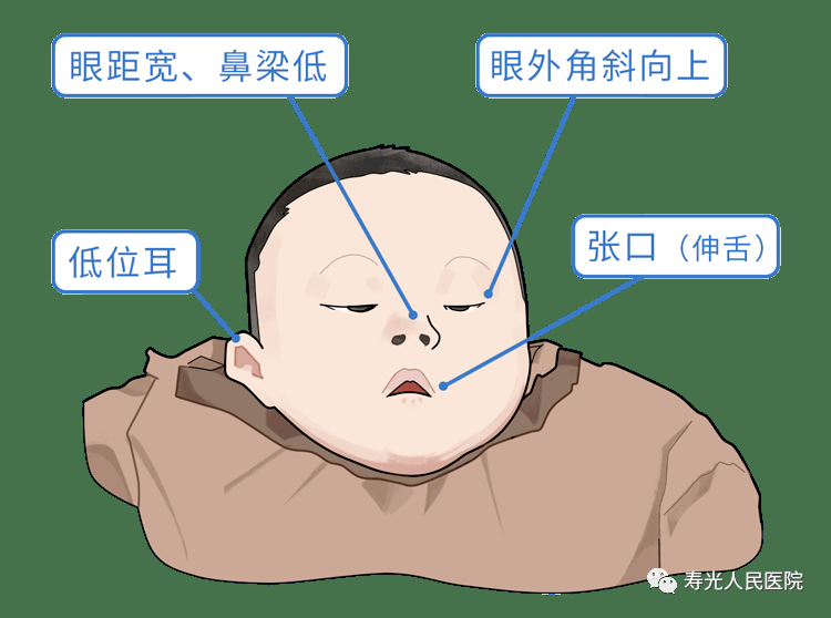 特殊面容 搜狐网