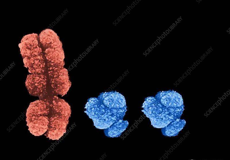 正常人的染色体46条,而xyy综合征的人,染色体数为47条,性染色体为xyy