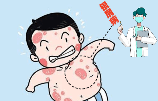 危害大吗?_治疗_关节炎_患者