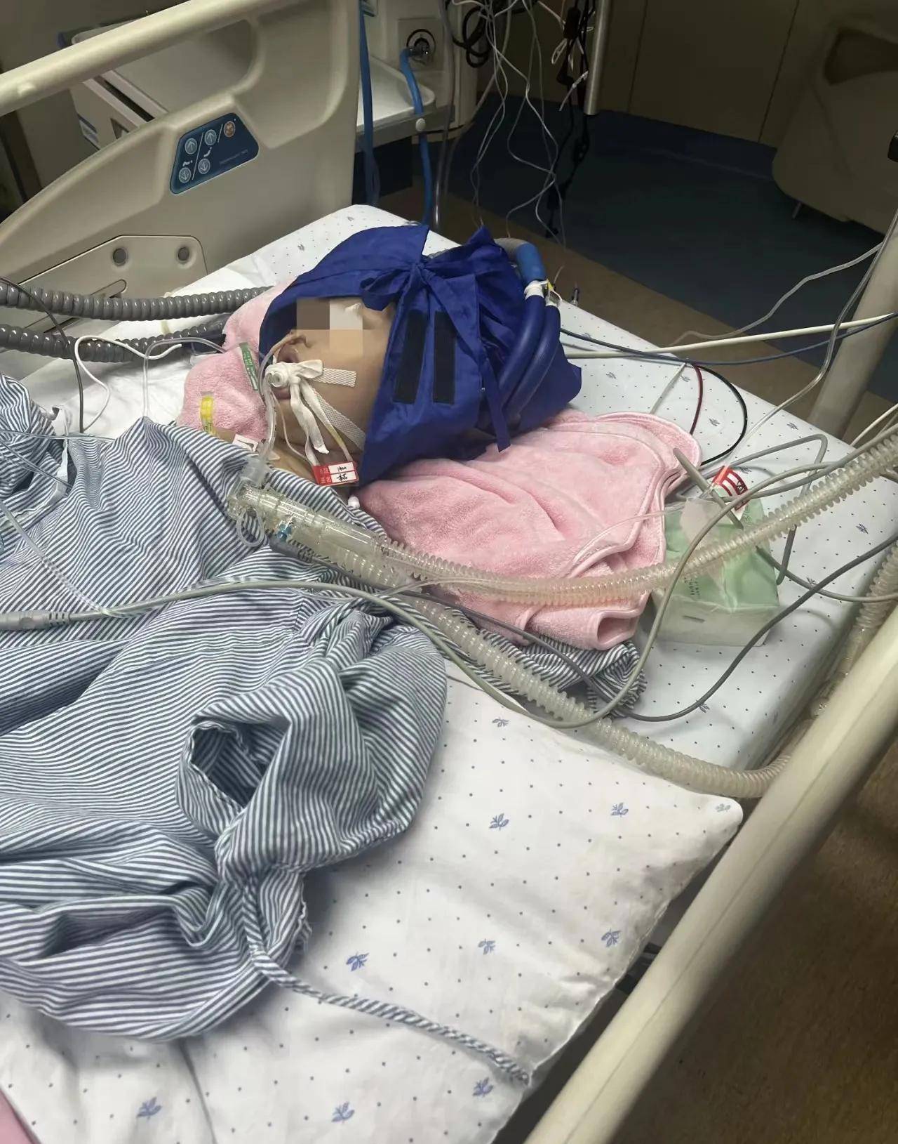 温州知名医院:活泼可爱的6岁小女孩做腿部康复针灸导致全身插管_孩子